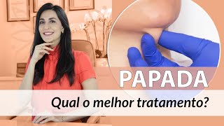 Papada  como escolher o melhor tratamento para diminuir a papada no pescoço [upl. by Yessej455]