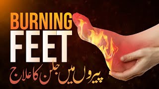 Pairon Mein Jalan Hona Ka Ilaj  Burning Feet Syndrome  Symptoms Causes amp Treatment in Urdu Hindi [upl. by Cleland937]