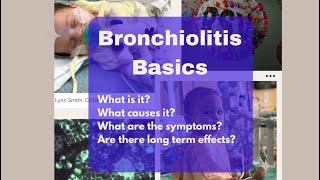 Bronchiolitis [upl. by Aicad]