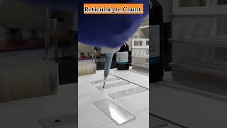 Reticulocyte Count Full Process youtubeshorts viral shortsvideo dmlt ytviral feedshorts [upl. by Rolando]