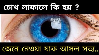 চোখ লাফলে কি হয়  ডান ও বাম চোখ লাফালে কি হয়  Eye jumps effect [upl. by Artemla]