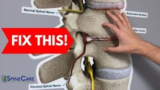 How to Fix a Bulging Disc in Your Lower Back  RELIEF IN SECONDS [upl. by Irby]