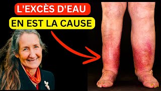 15 ans de jambes et de pieds enflés disparus en quelques minutes  La découverte de Barbara ONeill [upl. by Giltzow]