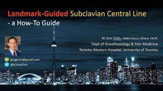 LANDMARKguided Subclavian Central Line Insertion  a HowTo Guide [upl. by Yeoj]