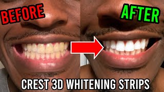 Using Crest 3D Whitestrips in 2022 Honest Review  How to Whiten Yellow Teeth [upl. by Yenttirb]