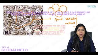 PITUITARY GLAND AND PARATHYROID GLANDS By DrIlla jain khandelwalPathology by Marrow Video Lecture [upl. by Werbel]