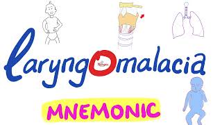 Laryngomalacia Mnemonic  Pediatrics ENT [upl. by Rtoip]