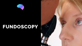 Fundoscopy Ophthalmoscopy  OSCE Guide  UKMLA  CPSA [upl. by Haldane678]