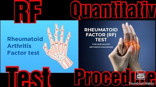 RF Q Rheumatoid factor test procedure in lab [upl. by Eityak]