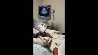 Emergency Ultrasound Guided Percutaneous Nephrostomy Tube placement [upl. by Torbert]