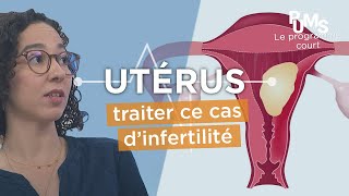 TUMEURS BÉNIGNES UTÉRINES  le meilleur traitement [upl. by Htessil]