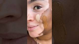 How to apply foundation with vitiligo skin  Onella using Fenty Beauty Foundation shades 110 and 420 [upl. by Yelrihs971]