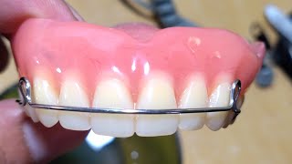 Pustiso with Retainer or Denture with Retainer [upl. by Immac651]