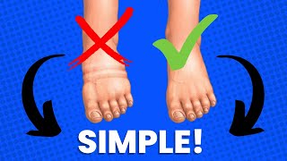 Simplest Ways To Stop Ankle Swelling amp Pain [upl. by Aiveneg]