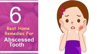 6 Best Home Remedies For Abscessed Tooth [upl. by Alexei382]