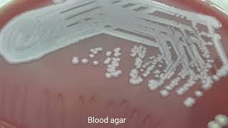 Citrobacter farmeri growth on CLED agar Blood agar and MacConkey medium [upl. by Nylodnewg]