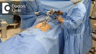 Cost of Gynaecologic Laparoscopic Surgery  Dr Shafalika Boriah [upl. by Bayer]