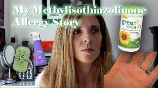 My Methylisothiazolinone allergy and dyshidrotic hand eczema story [upl. by Demetra588]