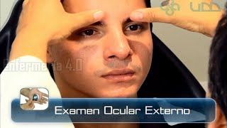 🌟EXAMEN OCULAR EXTERNO🌟 [upl. by Naruq]