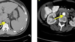 Introduction to Radiology Computed Tomography [upl. by Rorke]