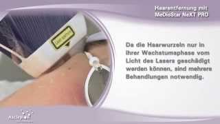 Haarentfernung mit dem Diodenlaser MeDioStar NeXT PRO von Asclepion [upl. by Iloj]