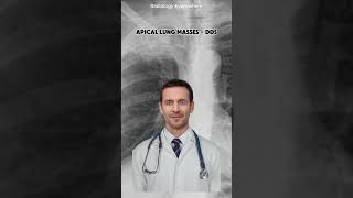 Apical Lung Masses Differential Diagnoses radiology everywhere [upl. by Flan151]