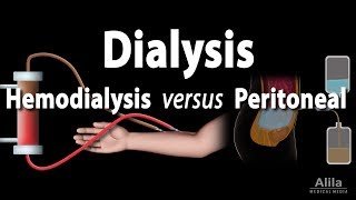 Renal Replacement Therapy Hemodialysis vs Peritoneal Dialysis Animation [upl. by Deloris]