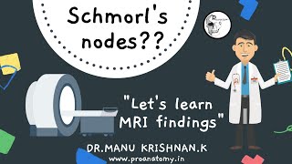 MRI findings What are schmorls nodes [upl. by Aekin]