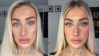 How to Contour a Crooked Nose Wow the difference [upl. by Naj964]