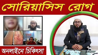 সোরিয়াসিস রোগের লক্ষণ  সোরিয়াসিস রোগের চিকিৎসা  সোরিয়াসিস থেকে মুক্তির উপায় Psoriasis Patient [upl. by Eirrehc]