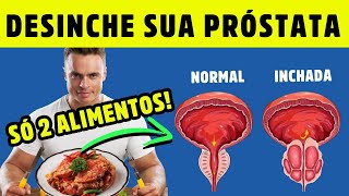 2 ALIMENTOS simples para DESINCHAR sua PRÓSTATA AGORA Dr Alain Dutra [upl. by Belldas834]