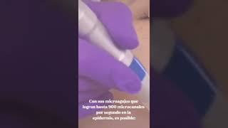 ¡Descubre el efectivo tratamiento Nanopore ya disponible en Puebla belleza medicinaestetica [upl. by Lisab143]