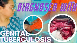 I was Diagnosed with Genital Tuberculosis🥹Day 1175 Hard Study📚Challenge medico 75hardchallenge [upl. by Brok]