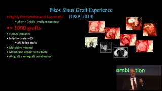 Sinus Elevation Surgery Infections sample [upl. by Rawdan]