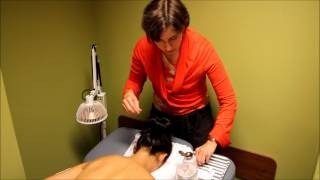 Acupuncture Demonstration and Benefits [upl. by Cattima]