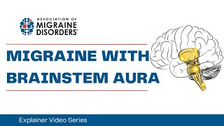 What is Migraine with Brainstem Aura  Chapter 1 Migraine Types  Explainer Video Series [upl. by Snow]