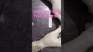 VDRL ANTIGEN TEST POSITIVE medicalcollegestudents youtubeshorts ytshorts lab [upl. by Beshore]