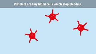 What causes DVT and how can we stop it [upl. by Yrennalf]