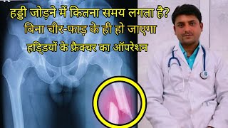 Fracture healing stage of fracture healing in hindi [upl. by Auerbach]