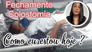 REVERSÃO DE COLOSTOMIA COMO EU ESTOU HOJE [upl. by Karla]