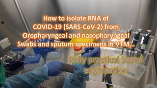 COVID19 SARSCOV2 RNA Extraction for molecular tests [upl. by Arahsat97]