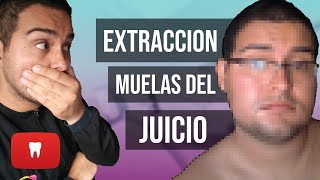 Extracción de muelas del juicio y pericoronatis  ¿Por qué se extraen las cordales © [upl. by Durno]