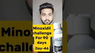 Minoxidil challenge For 90 DaysDay46 hairfallcontrol minoxidil viralreels viralshorts hair [upl. by Hardie410]