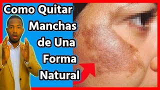 Tratamiento casero para las MANCHAS EN TU CARA es totalmente natural [upl. by Darej899]