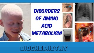 disorders of amino acid metabolism [upl. by Robbin]