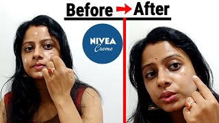 Nivea Cream Use in Night For Dry amp Oily Skin  Instant Fairness Cream Benefits Review in Hindi [upl. by Ellitnahc]