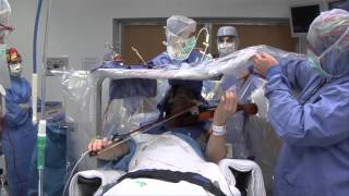 Violinist Still Making Music After DBS Surgery  Mayo Clinic [upl. by Tuck]