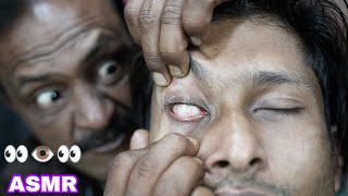 Eye Massage And Eyelid Cracking By Big Eyes Barber  ASMR Eye Massage  ASMR Forehead Massage [upl. by Eelanej]