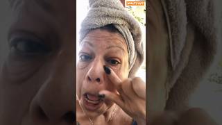 Miracle eye cream that erases her eye bags in less than three minutes shorts viral [upl. by Niltyak]