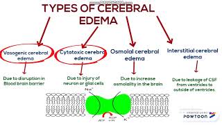 Cerebral edema [upl. by Fruin]